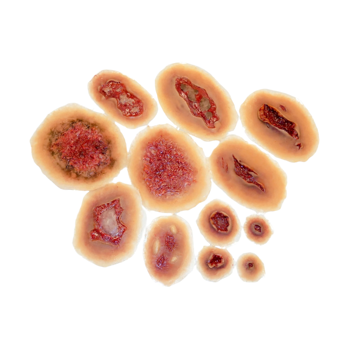 Zestaw samoprzylepnych ran Techline Self Adhesive Wounds™ Kit